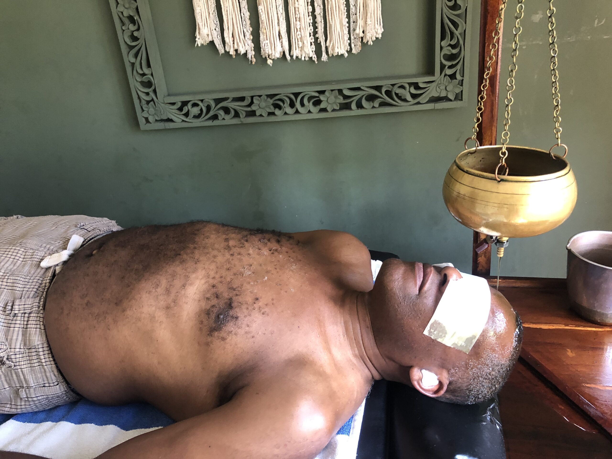 Mike Lawrence receiving a traditional Shirodhara treatment during a wellbeing retreat in Sri Lanka